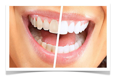 estetska stomatologija